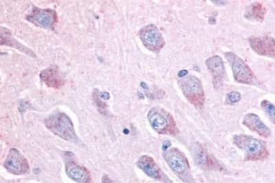 Immunohistochemistry-Paraffin: LINGO-1 Antibody [NBP3-14392] - Immunohistochemistry of formalin-fixed, paraffin-embedded human hippocampus after heat-induced antigen retrieval.